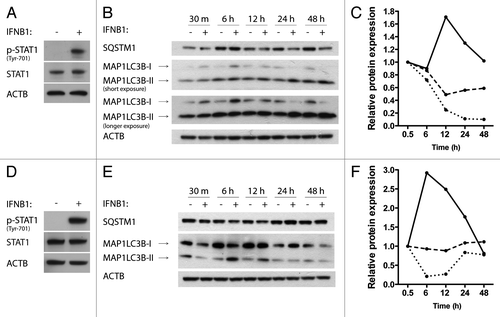 Figure 3. IFNB1 induced autophagy in MDAMB231 and SKBR3 breast cancer cells. (A) MDAMB231 cells were IFNB1-responsive. MDAMB231 cells were cultured for 24 h, serum starved for 3 h and stimulated with control medium or 1000 U/ml of IFNB1 for 30 min. Western blot analysis was performed for p-STAT1, STAT1 and ACTB proteins. (B and C) IFNB1 induced autophagy in MDAMB231 cells. (B) MDAMB231 cells were cultured for 24 h and then treated with control medium or 1000 U/ml IFNB1 for the indicated time intervals. Western blot analysis was performed for SQSTM1, MAP1LC3B and ACTB protein levels. The blot is representative of two independent experiments. (C) Quantification of the results shown in (B). The values are normalized to the time-point control, and further to the 30 min time-point set to 1, and represent average values from two independent experiments. The full line shows relative MAP1LC3B-II/ACTB levels, the dotted line shows relative MAP1LC3B-I/MAP1LC3B-II levels and the dashed line shows relative SQSTM1/ACTB levels. (D) SKBR3 cells were IFNB1-responsive. SKBR3 cells were cultured for 24 h, serum starved for 3 h and stimulated with control medium or 1000 U/ml of IFNB1 for 30 min. Western blot analysis was performed for p-STAT1, STAT1 and ACTB protein levels. (E and F) IFNB1 induces autophagy in SKBR3 cells. (E) SKBR3 cells were cultured for 24 h and then treated with control medium or 1000 U/ml IFNB1 for the indicated time intervals. Western blot analysis was performed for SQSTM1, MAP1LC3B and ACTB levels. The blot is representative of two independent experiments. (F) Quantification of the results in (E), as described in (C).
