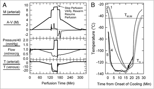Figure 1 (A) Perfusion protocol for renal survival after vitrification and rewarming. M, molarity; A-V (M), arteriovenous difference in molarity; T, temperature in degrees Celsius. The protocol, as usual,Citation6,Citation39 employs an initial 5 M plateau, a second plateau at 8.4 M to allow cooling to −22°C without freezing, and a final plateau during M22 perfusion. In the experiment shown, the perfusion was interrupted at the point shown to enable the kidney to be vitrified, rewarmed and reperfused with 8.4 M cryoprotectant at −3°C. (B) Thermal history of the transplanted kidney based on invasive temperature measurements in a model rabbit kidney cooled and rewarmed by a procedure identical to that used for the vitrified-transplanted rabbit kidney. Line 1: inner medullary temperature, as documented by a thermocouple located 1.2 cm below the renal surface; line 2: outer medullary temperature, measured 7 mm below the renal surface; line 3: cortical temperature 2 mm below the renal surface; line 4: environmental temperature of the test kidney; line 5: environmental temperature of the kidney that was transplanted after previous vitrification. TM,IM, estimated melting point of inner medullary tissue (upper horizontal line); TG, estimated glass transition temperature of inner medullary tissue (lower horizontal line).