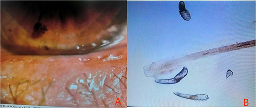 Figure 2 Ocular Mite Examination Results.