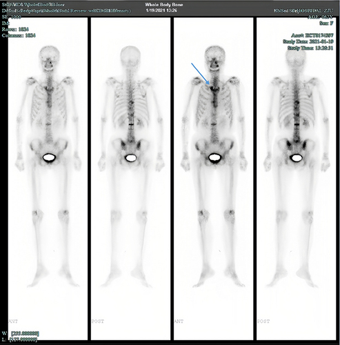 Figure 4 Skeletal ECT imaging.