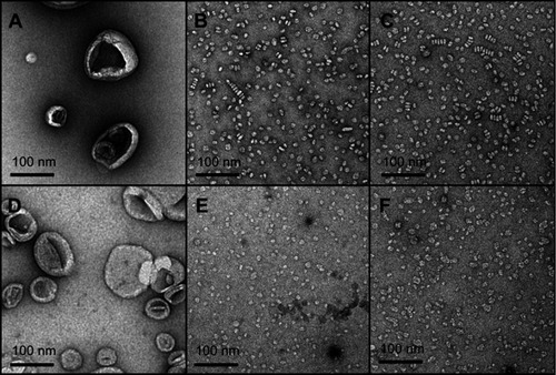 Figure 4 Transmission electron microscopy (TEM) images of large unilamellar vesicles (LUVs) of egg sphingomyelin (eSM) (A) and 1-palmitoyl-2-oleoyl-sn-glycero-3-phosphocholine (POPC) (D); sHDL nanoparticles formed following 1-hr incubations of 22A peptide with eSM (B) and POPC (E) LUVs at 37°C and with eSM (C) and POPC (F) LUVs at 50°C.