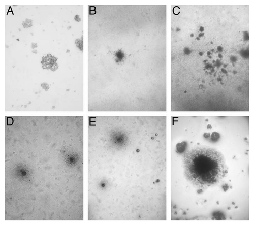 Figure 1. Light microscopy of control BCG-D colony (A), and typical “fried eggs” L-form colonies grown on Middlebrook 7H9 semisolid agar: colonies of filterable forms developed from control BCG-BG suspension (B) and (C) and .colonies obtained after starvation of BCG-BG (D) and (E) and BCG-D cultures (F). Magnification: (C)–200x; (A), (B), (D), (E) and (F)-400x; (F)-800x.