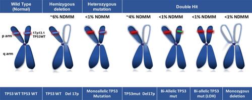 Figure 1 Chromosome 17p13 and TP53 aberrations in multiple myeloma.