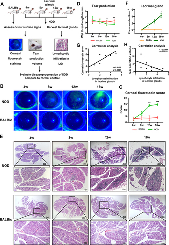 Figure 1 The severity of dry eye showed progressive exacerbation with increasing age of NOD mice. (A) Time-point selection and experimental design flow for the course studies of SS-related dry eye in NOD mice. n=6-9 mice per group. (B and C) The representative photographs (B) and grading scores of corneal fluorescein staining (C) in different age groups of NOD mice and healthy BALB/c controls. n=6 mice per group. (D) Phenol red cotton threads measurement of tear secretion in NOD mice and healthy BALB/c mice at different time points. n=6-9 mice per group. (E and F) Histopathological analysis of the LGs in NOD mice at different ages. Representative images (E) and quantification (F) show lymphocytic infiltration in LGs. n=3. (G) Spearman rank correlation between the lymphocytic infiltration in the LGs and corneal fluorescein staining scores. n=3. (H) Correlation analysis between the LGs inflammation and tear secretion volume in NOD mice. n=3. Values are represented by means ± SD. Kruskal–Wallis test for multiple comparisons was used. *p<0.05, **p<0.01, or ***p<0.001, compared with 4-week-old group.