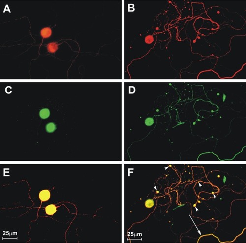 Figure 2 Challenge virus standard infection, but not mock infection, induces formation of 4-hydroxy-2-nonenal (4-HNE)-labeled axonal swellings.Citation51 Fluorescence microscopy showing mock-infected (A, C, and E) and challenge virus standard-infected (B, D, and F) dorsal root ganglion neurons at 72 hours postinfection. β-tubulin (A and B) is a marker of dorsal root ganglion neuronal cell bodies and axons (red) and expression of β-tubulin in challenge virus standard-infected neurons (B) showed multiple axonal swellings but a lack of axonal swellings in mock-infected neurons (A). 4-HNE (green) was poorly expressed in the axons of mock-infected dorsal root ganglion neurons (C) but showed greater expression in the axons of challenge virus standard-infected neurons (D) and accumulation in regions with axonal swellings (D). In challenge virus standard-infected neurons, merging of signals for β-tubulin and 4-HNE (yellow) showed there was strong expression of these elements in axons, both with axonal swellings (arrowheads) and without axonal swellings (arrow, F), but not in mock infected neurons (E).Copyright © 2010, American Society for Microbiology. Adapted with permission from Jackson AC, Kammouni W, Zherebitskaya E, Fernyhough P. Role of oxidative stress in rabies virus infection of adult mouse dorsal root ganglion neurons. J Virol. 2010;84:4697–4705.Citation51