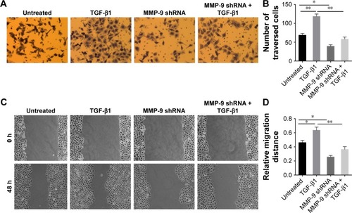 Figure 4 MMP-9 knockdown inhibits invasive and metastatic potential of EC-1 cells and blocks TGF-β1-induced cell invasion and metastasis.