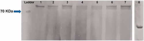 Figure 5. Western blot results of the presence of STAT3 protein. The numbers were implied to (1) purified STAT3 protein from HeLa cells as the controls, the other samples were pointed to the STAT3 protein from the MCF7 cells, treated with (2) STAT3 siRNA/NPs, (3) free NPs, (4) MTX/NPs, (5) MTX/siRNA/NPs, (6) free NPs and (7) untreated cells as the second controls (8) GAPDH protein as the internal control. NPs: MSN-APTES-chitosan.