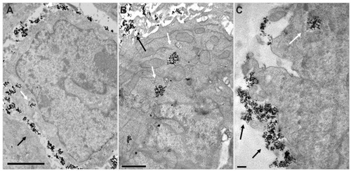 Figure 6 MNP uptake into human colorectal cancer cells. Electron micrographs of LS174T cells incubated with MF MNP (A) or MF-anti-CEA MNP (B) and HCT116 cell incubated with MF-anti-CEA MNP (C).Notes: Arrows point to MNP aggregates. Bars = 2 um (A) 1 μm (B) 0.5 μm (C).Abbreviations: MNP, maghemite nanoparticle; MF, magnetic fluid; CEA, carcinoembryonic antigen.