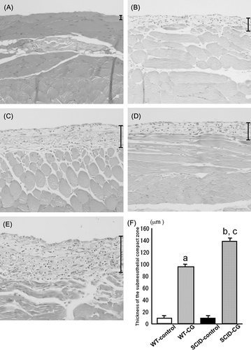 Figure 1. Hematoxylin and eosin staining of peritoneal tissues. The monolayer of mesothelial cells that covers the surface of peritoneum in normal mice (A). Chlorhexidine gluconate (CG) injection induced significant thickening of the peritoneum at day 8 (B) and day 16 (C) in WT mice. In SCID mice, the peritoneal tissues became thicker than that of WT mice at day 8 (D) and day 16 (E). Bars indicate the thickness of the submesothelial compact zone. Magnification, ×100. The average thickness of the submesothelial compact zone in WT control mice (WT-control), CG-injected WT mice (WT-CG), SCID-control mice (SCID-control), and CG-injected SCID mice (SCID-CG) at day 16 (F). Data are presented as the mean ± SD. a: p < 0.01 versus WT-control; b: p < 0.01 versus SCID-control; c: p < 0.01 versus WT-CG.