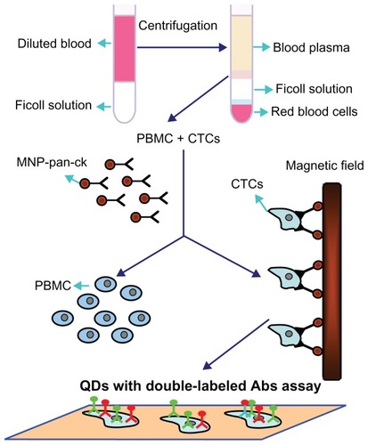 Figure 9 Schematic illustration of the isolation and identification of CTCs with MNP-pan-ck and QDs with double-labeled antibody.Abbreviations: Abs, antibodies; CTCs, circulating tumor cells; MNP-pan-ck, MNPs coupled with pan-cytokeratin antibody; PBMC, peripheral blood mononuclear cell; QDs, quantum dots.