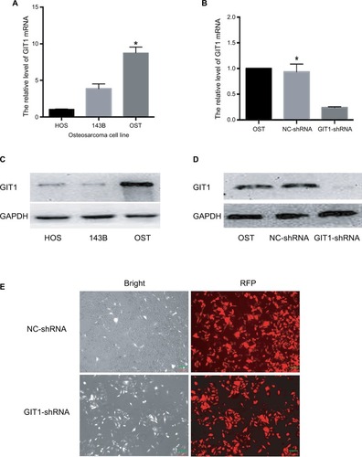 Figure 2 Knockdown efficacy of GIT1.Notes: (A) The relative transcription of GIT1 mRNA in three kinds of osteosarcoma cell lines (HOS, 143B and OST) detected by qRT-PCR. (B) The knockdown efficacy by GIT1-shRNA in OST cells detected by real-time RT-PCR. (C) The relative expression of GIT1 protein in three kinds of osteosarcoma cell lines (HOS, 143B and OST) detected by Western Blotting. (D) The knockdown efficacy by GIT1-shRNA in OST cells detected by Western Blotting. (E) Microscopic images of OST infected with lentivirus. One-way ANOVA for comparing GIT1 mRNA among HOS, 143B and OST cells or among blank, NC-shRNA and GIT1-shRNA groups was conducted respectively (scale bar: 100 µm; *P<0.05).