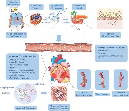 Figure 2 Pathophysiological mechanisms influencing the development of cardiac injury in SAP. Various risk factors (gallstones, alcohol, diet and drugs) cause acinar cell damage and the release of pancreatic hydrolase, leading to excessive activation and autocrine of macrophages and neutrophils, resulting in the accumulation of a large number of pro-inflammatory factors. Then the local inflammation at the lesion is amplified through the inflammatory cascade effect, which eventually results in necrosis and hemorrhage of most pancreatic tissue, releasing more and more cytokines, and induces hypercytokinemia (a cytokine storm). As the disease progresses and pancreatic inflammation involves the intestine, it causes dysfunction of intestinal barrier, which leads to the migration of intestinal flora to the pancreas and blood, followed by pancreatic infection and sepsis. These high levels of risk factors (including trypsin, endotoxin and cytokines) in the blood can damage vascular endothelial cells, trigger systemic inflammatory response, lead to myocardial microcirculatory disturbance, autonomic nerve dysfunction and abnormal autophagy, and eventually result in myocardial injury and cardiac dysfunction.