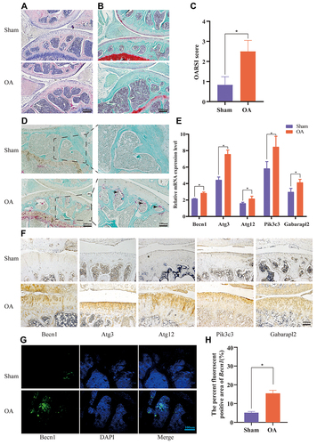 Figure 5 Experiential verification in vitro and in vivo. HE staining (A), Safranin O-Fast Green staining (B) and OARSI scores (C) were shown in the sham group and the OA group. TRAP staining in tibial subchondral bone between two groups (D). Comparison of mRNA expression levels between the two groups (E). Immunohistochemical observation of these five DEGs between two groups (F). Immunofluorescence staining of Becn1 (G) and analysis of fluorescence intensity (H) in the OA group compared to the sham group. Asterisk (*) representing statistical difference is p<0.05.