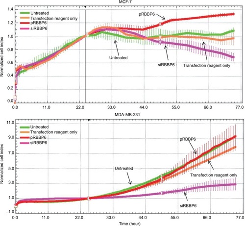 Figure 5 Growth of MCF-7 and MDA-MB-231 cells in the presence of siRBBP6 and pRBBP6 analyzed using the xCELLigence system.