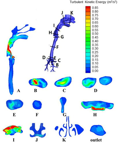 Figure 4. Turbulent kinetic energy at various sections for breathing rate of 30 L/min.