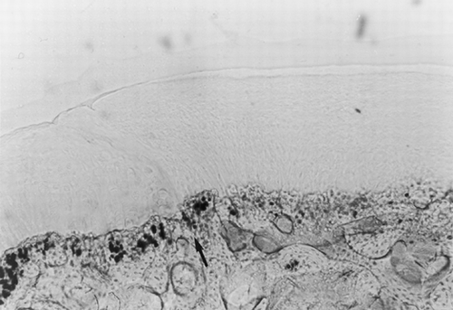 Figure 1. Osteochondral defect at 24 weeks after laser treatment (toluidine blue). Magnification: ×10. Complete healing of the osteochondral defect surgically created; the arrow shows the border between repaired tissue (right) and adjacent tissue (left). The repaired tissue has an overall good structural integrity with a smooth and regular articular surface.