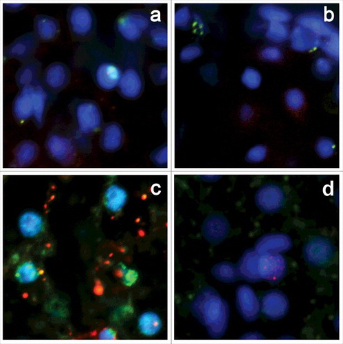 Figure 2. Double labeling of zebrafish 4dpf embryo cryosections for ETUNEL and apoptosis, proliferation and reparation markers. There is no evidence of colocalization between ETUNEL and PARP (a), caspase 3 (b), PCNA (c) and γH2AX (d) markers.