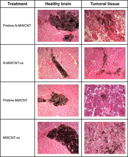 Figure 14 Histological sections of healthy rat brain and tumoral tissue from the left side of brain after intratumoral injection of MWCNTs (magnification 200×).Notes: No signs of inflammation by mononuclear cell infiltration were seen in all treated tissues. MWCNTs were more concentrated in healthy brain compared with tumoral tissue.Abbreviations: MWCNT, multiwalled carbon nanotube; N-MWCNT, nitrogen-doped MWCNT; N-MWCNT-ox, acid-treated nitrogen-doped MWCNT; MWCNT-ox, acid-treated MWCNT.
