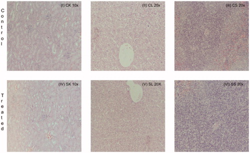 Figure 8. Histopathologic damage due to CS. The mice were daily gavaged with 200 μg CS/kg or vehicle only for 10 days. At 24 h after the final dosing, the host liver, kidney, and spleen were isolated and prepared for histopathology. Representative sections are shown; Magnification = 10–40×. (I) Control mouse kidney, (II) Control mouse liver, (III) Control mouse spleen, (IV) CS mouse kidney, (V) CS mouse liver and (VI) CS mouse spleen.