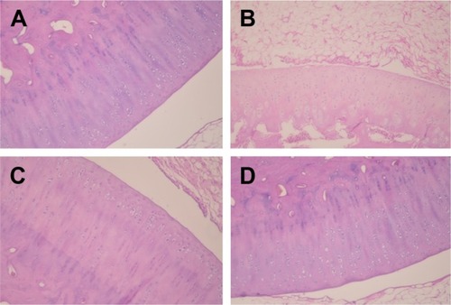 Figure 3 Histological evaluation of cartilage from different treatment groups after OA induction.
