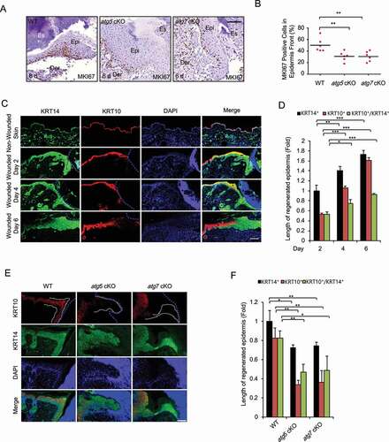 Figure 2. Keratinocyte autophagy deficiency inhibits cell proliferation and differentiation in vivo. (A) Immunohistochemical (IHC) staining of MKI67 in wound sections on day 6 in WT and atg5 cKO mice. Scale bar: 50 μm. (B) Quantification of the percentage (%) of MKI67-positive cells in newly regenerated epidermis in A (n = 6). (C and E) Immunofluorescence staining of KRT14 (green), KRT10 (red), and nucleus (blue, DAPI) in non-wounded and wounded skin on day 2, 4, and 6 post-wounding in WT mice (C) or in wounded skin on day 4 in WT, atg5 cKO, and atg7 cKO mice (E). Scale bar: 200 (C) and 100 (E) μm. (D and F) Quantification of C (D) and E (F) (n = 3). All bars represent mean ± SD. *, P < 0.05; *, P < 0.01; ***, P < 0.001; Student’s t-test