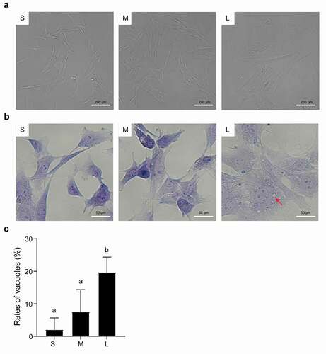 Figure 2. Microscopic assessment of morphological structure of PFFs of different sizes. A. Morphological structure of small (s), medium (m) and large (l) cells as assessed by microscopy (10×). B. Phenotype of vacuoles in small (S), medium (M) and large (L) cells as assessed by microscopy (40×); the red arrow refers to the clear vacuoles. C. Quantitative analysis of vacuoles scattered in different sized PFFs. The results are presented as the mean±SD. Data are representative of three independent experiments (a, b, cP<0.05)