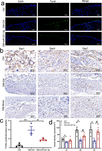 Figure 2 Effects of miR-221-3p on apoptosis and angiogenesis in diabetic mice. The TUNEL assay was performed to examine the role of diabetes and miR-221-3p overexpression on the apoptosis of epithelial layer at the edge of the wound (a and c). TUNEL-positive cells are shown in green and the nuclei are labeled with DAPI (blue). Scale bar is 50 µm. Angiogenesis analysis by immunohistochemistry staining of CD31 in dorsal skin sections from normal mice and diabetes mice injected with either Ctrl or miR-221-3p, quantified by the number of blood vessels per unit area (b and d). Scale bars, 50 μm. Data are presented as mean ± SEM, n = 3–5. *P < 0.05, **P < 0.01 for Ctrl vs DM-Ctrl. #P < 0.01 for DM-Ctrl vs DM-miR-221-3p.