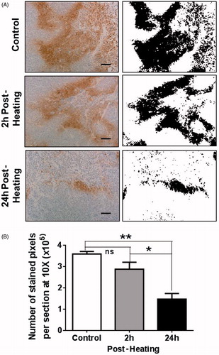 Figure 4. Mild systemic heating improves tumour oxygenation. (A) Hypoxic areas in tumour sections were identified using immunohistochemistry (IHC) to label pimonidazole hydrochloride (Hypoxyprobe-1) adducts of proteins and peptides that are formed at low oxygen tension. Panels on the left are micrographs (10×) from tumour sections from a control unheated mouse and from heated mice 2 h and 24 h post-heating. Panels on the right are binary images of the micrographs on the left; the binary threshold was done using NIH ImageJ. The micrographs show extensive hypoxic areas in the control tumour and in the tumour 2 h post-heating. The hypoxic area is much reduced at 24 h post-heating. (B) A plot of the number of IHC stained sections from unheated control mice and those from mice at 2 h and 24 h post-heating. The pixel counts were obtained using NIH ImageJ. There was no significant decrease in the number of hypoxic pixels at 2 h post-heating but at 24 h post-heating there was significant decrease in hypoxia in the tumours. Scale bar = 100 µm (n = 3 per group, ANOVA *p < 0.05; **p < 0.01).