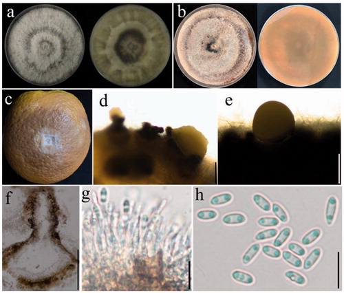 Figure 3. Diaporthe siamensis (YZU 181403). (a, b). Front and back view, respectively of colonies on PDA (a) and OA (b); (c). Pathogenicity test on Citrus sinensis fruit for 7 d; (d, e). Conidiomata; (f): Section view of conidiomata; (g). Conidiophores; (h): Alpha conidia. Scale bars: d, e, f = 100μm; g, h: 10 μm.