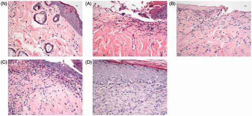 Figure 6. Histological photomicrographs of rats’ skin (H&E stain × 20, N. Normal control group; (A) Model group; (B) Ultrasound group; (C) GLT nanogel group; (D) GLT nanogel + TUS group).