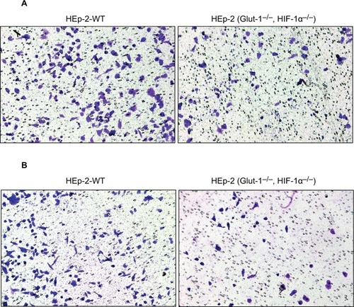 Figure 6 Effects of HIF-1α and GLUT-1 double gene knockout on the migration or invasive capacity of HEp-2 cells assessed by Transwell assays.Notes: (A) The migration capacities of cells were significantly lower after HIF-1α and GLUT-1 double gene knockout compared with before HIF-1α and GLUT-1 double gene knockout. (B) The invasive capacities of cells were significantly lower after HIF-1α and GLUT-1 double gene knockout compared with before HIF-1α and GLUT-1 double gene knockout.Abbreviations: GLUT, glucose transporter; HIF-1α, hypoxia-inducible factor-1α.