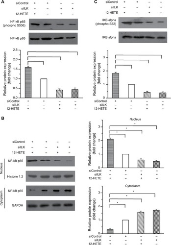 Figure 4 12-HETE promotes the activation and nuclear translocation of NF-κB through the ILK pathway.Notes: (A) 1 µM 12-HETE treatment led to increased levels of phosphorylated NF-κB p65 but was antagonized by the knockdown of ILK. (B) 1 µM 12-HETE significantly increased the protein level of nuclear NF-κB p65 and decreased the protein level of NF-κB p65 in the cytoplasm via ILK. (C) The 12-HETE-induced phosphorylation of IKBa was mediated by ILK in ovarian cancer cells. All values are represented as the mean±SEM from three or more independent batches of cells (*P<0.05).Abbreviations: IKBa, IKB alpha; ILK, integrin-linked kinase; NF-κB, nuclear factor kappa-B; SEM, standard error of the mean; 12-HETE, 12-hydroxyeicosatetraenoic acid.