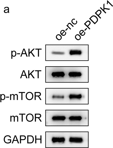 Figure 6. PDPK1 regulates the AKT/mTOR signal pathway. (a) Western blot was used to detect the expression and phosphorylation of AKT and mTOR.
