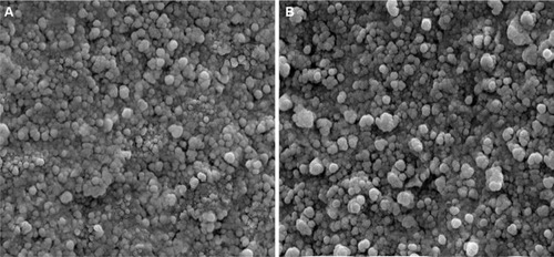 Figure 1 Scanning electron micrographs of exosomes isolated from urine samples of TCC patients (A) and control (B). The size of exosomes was not different between study groups.Abbreviations: TCC, transitional cell carcinoma.