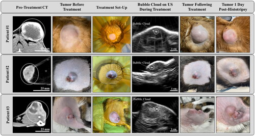 Figure 3. Representative images from the three feline patients show (from left to right) pretreatment CT scans revealing clearly demarcated soft tissue tumors (circled), pretreatment tumors after hair removal, water coupling baths positioned over the patient, bubble cloud formation during treatment visible on real-time US imaging, and various degrees of cutaneous injury in the histotripsy treatment path after treatment. Sutures in the skin images are from pretreatment tumor biopsies.