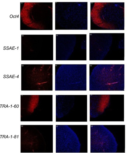 Figure 5 Immunohistochemical analysis of iPSCs.