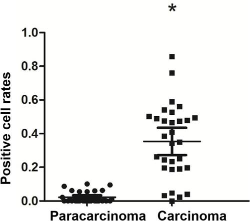 Figure 3 Syncytin-1 positive cell rate in NSCLC tissues and para-carcinoma tissues. The syncytin-1 positive cell rate in NSCLC tissues was higher than that in adjacent tissues. *Represents P<0.05.