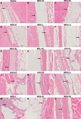 Figure 3 Hematoxylin and eosin staining at 1 and 4 weeks after subcutaneous injection of the saline control (A), NEU series (B–G), BEL-VL (H), JUV series (I–K), and RES series (L–O). Arrows indicate the location of the inflammatory cells. All images are shown at the same magnification (× 200).