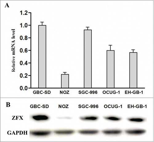 Figure 2. (A and B) The expression level of ZFX mRNA and protein in GBC cells.