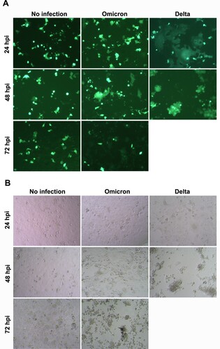 Figure 4. SARS-CoV-2 mediated cell-cell fusion. (A) Cell GFP images of infected cells at indicated post infection time. (B) Bright field images of infected cells at indicated post infection time. VeroE6/TMPRSS2 cells were transfected with GFP plasmid and infected with 0.1 TCID50 virus (Omicron and Delta variant). Images were taken at 24, 48, and 72 hpi. GFP-transfected cells without viral infection were the negative control of cell fusion (no infection). Scale bar = 50 μm. Experiment images were taken from two independent biological samples.