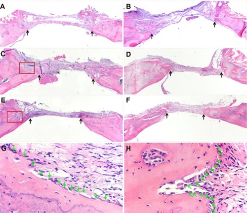 Figure 6 Hematoxylin and eosin staining of rat cranial defect after 4 or 8 weeks post-implantation. (A) Blank control group after 4 weeks (×20). (B) Blank control group after 8 weeks (×20). (C) EGFP/CS group after 4 weeks (×20). (D) EGFP/CS group after 8 weeks (×20). (E) BMP/CS group after 4 weeks (×20). (F) BMP/CS group after 8 weeks (×20). (G) Enlarged image of the edge of the defect in EGFP/CS group after 4 weeks (×400). (H) Enlarged image of the edge of the defect in BMP/CS group after 4 weeks (×400). Black arrows indicate the edge of the defect, and green arrows indicate osteoblasts.Abbreviations: BMP/CS, bone morphogenetic protein 2 gene-modified cell sheet; EGFP/CS, enhanced green fluorescent protein gene-modified cell sheet.