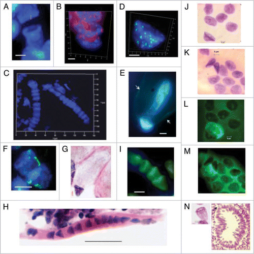 Figure 6 Bell shaped nuclei observed with various techniques in tissues, tumor and cell culture preparations. (A) DAPI stained DNA (blue) syncytial bell shaped nuclei in human fetal spinal cord ganglia, 8–9 wks. (B) DAPI staining (blue) and pan-telomeric FISH labeling (Cy3, red) of bell shaped nuclei in mouse fetal spinal cord ganglia tissue, 16.5 days. (C) DAPI stained syncytia with multiple bell shaped nuclei as seen in 3D imaging [Z-stack, ‘Apotome’], human fetal spinal cord ganglia, 9 wks. (D) High resolution 3D image of DAPI stained bell shaped nucleus and pan-centromeric FISH staining (FITC green), human colon adenocarcinoma, 68 yrs. (E) DAPI stained bell shaped nucleus dividing asymmetrically (bell to cigar shaped nucleus) in human colon adenocarcinoma, 68 yrs. [Arrows indicate the walls of the balloon shaped cytoplasm through which new eukaryotic nuclei migrate]. (F) DAPI stained bell shaped nucleus dividing symmetrically with segregation of pair of chromosomes 18 stained by FISH (FITC green), fetal spinal cord ganglia, 8–9 wks. (G) H&E staining of metakaryotic extra syncytial cell, colon adenocarcinoma, 68 yrs. (H) H&E staining of syncytial bell shaped nuclei, spinal cord, 8–9 wks. (I) Acridine orange stained syncytial bell shaped nuclei, spinal cord, 8–9 wks. (J and L) Feulgen stained DNA (purple) bell shaped nuclei appearing in human adenocarcinoma cell line. (K and M) Feulgen fluorescent (green) images of (J and L), respectively showing unidentified fluorescent material in cytoplasm of all cells of bell shape and with a small fraction of cells with spherical nuclei. (N) Feulgen stained bell shaped nucleus as seen in 30 microns snap frozen tissue section of human colon polyp, 27 yrs. Arrow indicates position of the nucleus relativel to aberrant crypt. Bar scales, 5 µm (A–N) except 50 µm in (H).