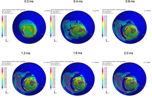 Figure 17 Sequential strain strength response of ocular surface of model eye upon airbag impact in straight position at 60 m/s with adhesion strength of scleral flap of 50%, shown at 0.4-ms intervals after 0.2 ms. Strain strength change is displayed in color as presented in the color bar scale (Figure 2).