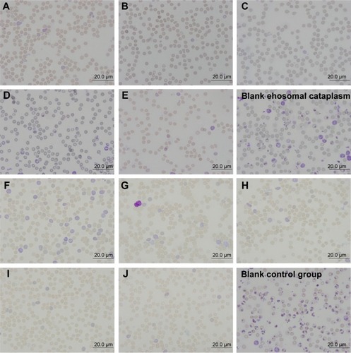 Figure 12 The optical microscope pictures of thin blood smears.Notes: Blank ethosomal cataplasm, blank control group and treatment groups (A–J) are shown. (A–E) Treated with conventional cataplasm; (F–J) treated with ethosomal cataplasm; specific administration dosages showed in Table 1.