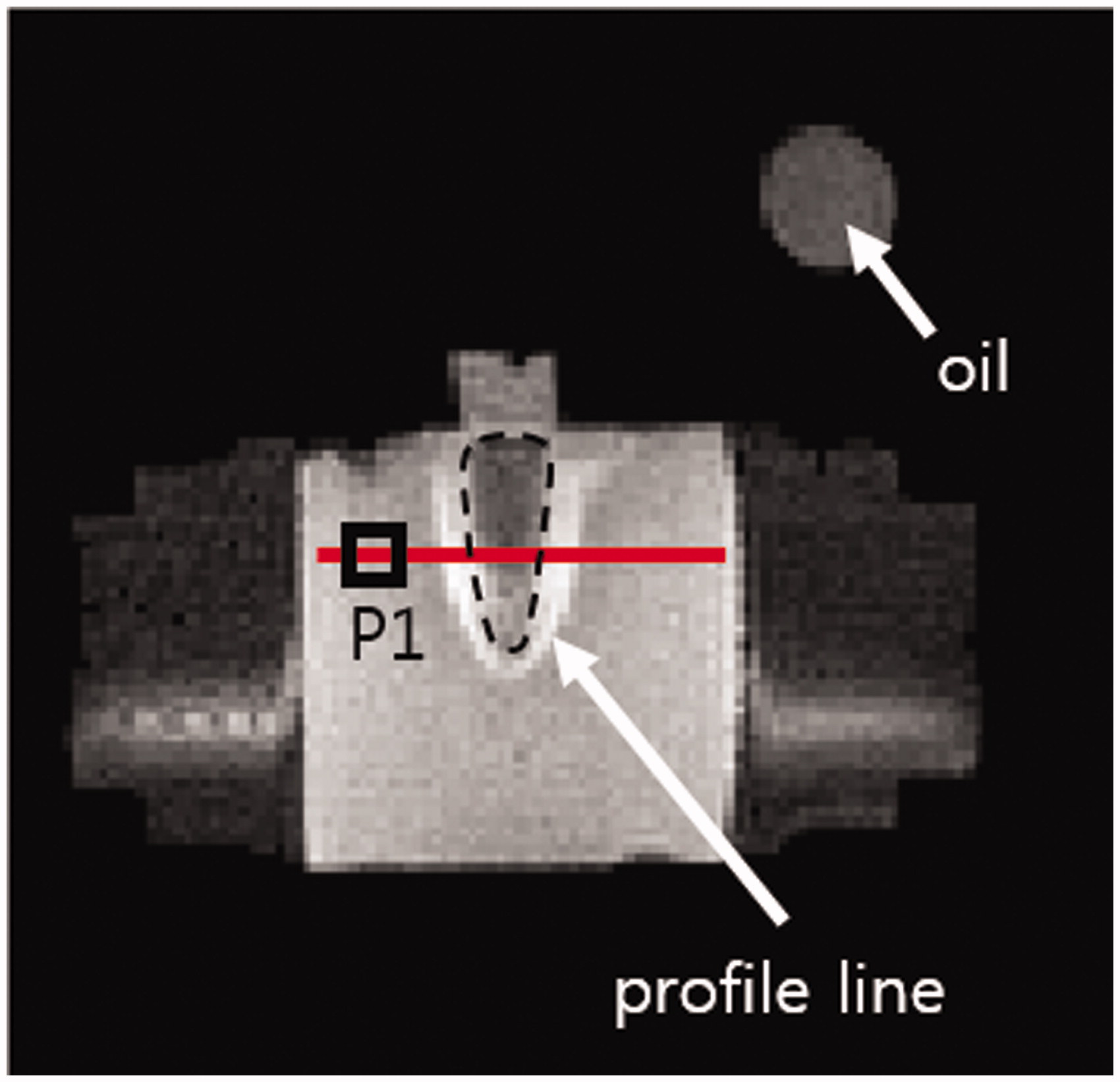 Figure 6. MR image of the phantom and oil tube on the mid-plane. Dashed line, tumour-mimicking compartment; red solid line, temperature profile; square P1, location of the fibre-optic temperature probe.