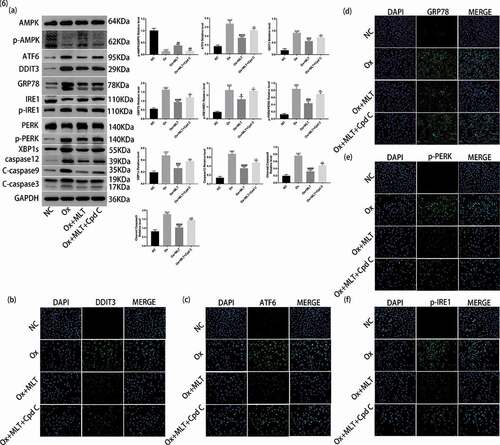 Figure 6. Role of AMPK activation on melatonin-mediated inhibition of ER stress. Cells in each group were treated for 12 h with 4 mmol/L Ox, 10 μmol/L MLT, and/or 5 μmol/L Cpd C 2HCl. (a) Western blot and corresponding histograms of DDIT3, GRP78, ATF6, PERK, p-PERK, IRE1, p-IRE1, XBP1s, caspase-12, cleaved caspase-3, cleaved caspase-9, p-AMPK, and AMPK protein expression relative to GAPDH. Immunofluorescence detection of (b) DDIT3, (c) ATF6, (d) GRP78, (e) p-PERK and (f) p-IRE1 protein expression (200× magnification). Anti-rabbit IgG (H + L), F (ab’) 2 Fragment (Alexa Fluor® 488 Conjugate) output green fluorescence. Data are presented as the mean ± SEM from three independent experiments. *P < 0.05, **P < 0.01, ***P < 0.001, ****P < 0.0001 versus the NC group; #P < 0.05, ##P < 0.01, ###P < 0.001, ####P < 0.0001 versus the Ox group; ^P < 0.05, ^^P < 0.01, ^^^P < 0.001, ^^^^P < 0.0001 versus the Ox + MLT group; ns: not significant