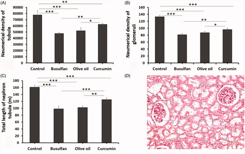 Figure 5. (A–C) The effects of curcumin on the busulfan-induced impairment in the number of glomeruli, nephron tubules, and tubule length. Mean ± SD of the number of glomeruli, nephron tubules, and tubule length in study groups (*p < .05, **p < .01, and ***p < .001). In the study groups (six animals per group) as compared by the ANOVA and LSD. (D) A schematic figure showing the protocol of study for optical disector method. ANOVA: analysis of variance; CM: conditioned medium; LSD: least significant difference.
