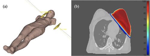 Figure 1. (a) A 3D view of an ICRP computational female phantom without hands, and (b) a transverse view with MC dose distribution of the FIF plan normalized at the isocentre.