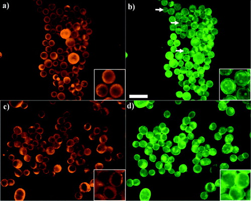 Figure 4 Distribution of E-cadherin and F-actin in PZ-HPV-7 (a and b, respectively) and DU-145 (c, d) cells exposed to ultrasound for 1 min. PZ-HPV-7 cells showed a ring-type distribution of E-cadherin (a) and internal regions of high phalloidin stain (b, arrows). In contrast, DU-145 cells displayed a granulated ring-type E-cadherin distribution (c), while no high phalloidin internal regions were observed (d). Zoom-in images highlight the distribution pattern. Scale bar is 50 μ m.