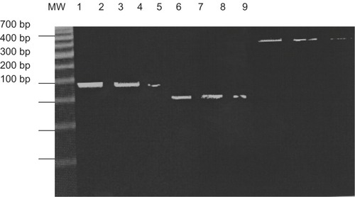 Figure 1 2% agarose gel electrophoresis of PCR product of serum SOD, GPx and CAT.